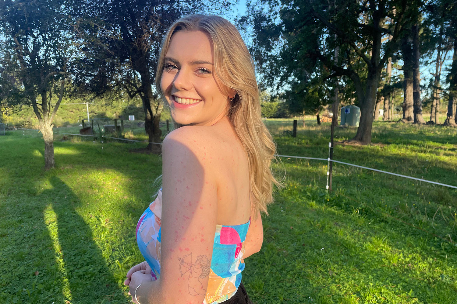 Living with a chronic skin condition